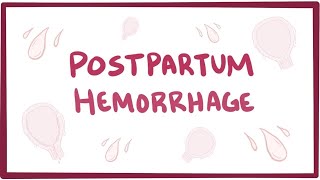 Postpartum hemorrhage  causes symptoms diagnosis treatment pathology [upl. by Thevenot]