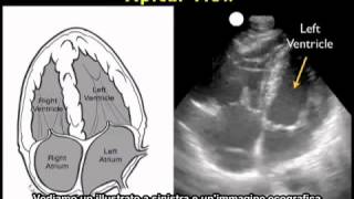 Video procedurale Ecografia cardiaca  Vista apicale [upl. by Seraphine]