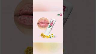 Sebamed lip Defence  Best lips balm for Men amp Women dermatology skincare lips 1mgofficial [upl. by Metzger]