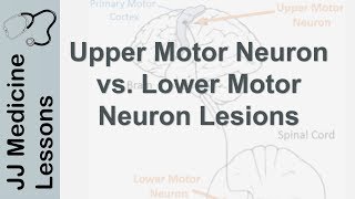 Upper and Lower Motor Neuron Lesions  UMN vs LMN Differences and Mnemonic [upl. by Ayotol]