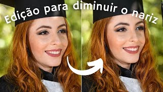 RINOPLASTIA COM APLICATIVO 👃 [upl. by Alyak]