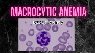 macrocytic anemia diagnosis Practical points [upl. by Durant]