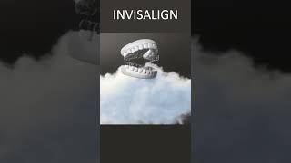 Invisalign Underbite  Time Lapse  London UK [upl. by Meneau]