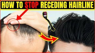 How to STOP Hair Loss amp Receding Hairline  Receding Hair Line Problem Men  Hindi [upl. by Carolynn34]