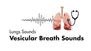 Breath Sounds in Different Clinical Conditions on Examination [upl. by Dillon911]