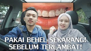 KENAPA KITA PAKAI BEHEL  MY DAMON CLEAR BRACES STORY 2 [upl. by Yael829]