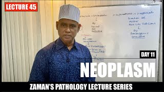 General Pathology Lecture 45  Neoplasm  Day 11 [upl. by Nalda]