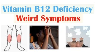 Vitamin B12 Deficiency Weird Symptoms amp Why They Occur [upl. by Jeri625]