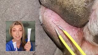 Removing impacted hair follicles satisfying video Dental care is important Here are your options [upl. by Fornof]