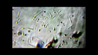 LACTOBACILLUS ACIDOPHILUS VISTO A 1500 INGRANDIMENTI [upl. by Creedon763]