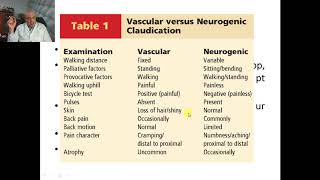 Tips in spine examination [upl. by Arej]