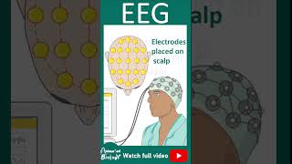 EEG  Electroencephalogram  How EEG works  1 minute pathology [upl. by Nahtanha]