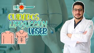 Cuidados después de una Liposucción Vaser [upl. by Aynot]