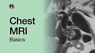 Chest MRI Basics [upl. by Anestassia]