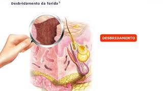 Papel da colagenase tópica na cicatrização de feridas [upl. by Imak969]