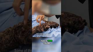 Tree Man Recovery Journey mustwatch viralvideo [upl. by Susann7]