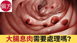 大腸息肉需要處理嗎 [upl. by Bron116]