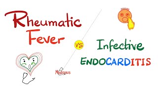 Rheumatic Fever vs Infective Endocarditis  Comparison  Cardiology Series [upl. by Roche]