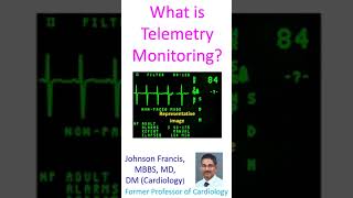 What is Telemetry Monitoring [upl. by Rubenstein]