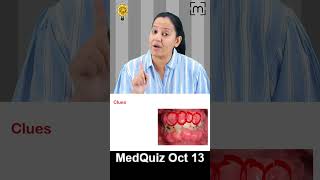 MedQuiz 13 Oct [upl. by Jona]