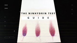 Ninhydrin Test A Detailed Guide to The Amines and Amino Acids Determination [upl. by Aicrag]