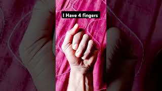 ￼ I have 4 fingers 😱😜🤣🤌🤞funny comedy funnyshorts shorts ￼ [upl. by Tychon]