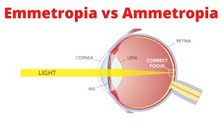 Emmetropia vs Ammetropia [upl. by Snebur]