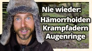 Nie wieder Hämorrhoiden Krampfadern amp Augenringe Diese Heilpflanze wirkt Wunder [upl. by Alrep]