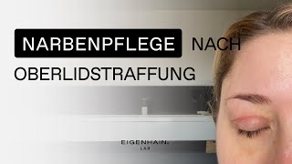 Narbenpflege nach OP  Erfahrung nach einer Oberlidstraffung Augenlidstraffung  LAB 17 [upl. by Koser]