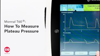 Monnal T60 How To Measure Plateau Pressure  S02E02 [upl. by Atsirk]