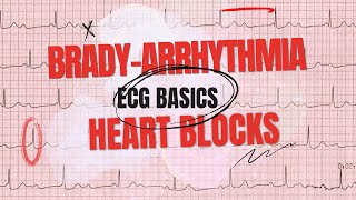 Heart blocks Explained  ECG basics part 3  SA blocks AV nodal blocks bundle branch blocks [upl. by Aseretairam]