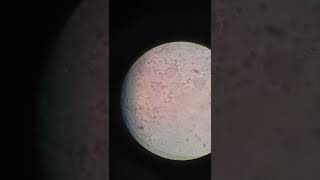 RBC in urine  Pus Cells  Bacteria under microscope  Part 2medicallabtechnologysajal6903 [upl. by Licna]