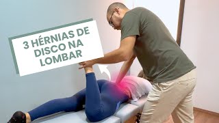 ELA TEM TRÊS HÉRNIAS DE DISCO UMA INFLAMAÇÃO E NÃO CONSEGUE APOIAR A LOMBAR AO DEITAR [upl. by Jessy104]