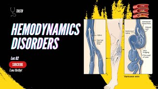 Pathology  Lec02 hemodynamics disorders  thrombosis and types of thrombi  TBSTB [upl. by Franci]