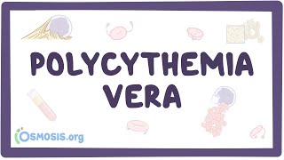 Polycythemia vera  causes symptoms diagnosis treatment pathology [upl. by Howarth]