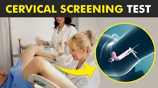 Pap Smear Pap Test  Early Detection for Cervical Cancer  Understanding the Procedure [upl. by Buyers521]