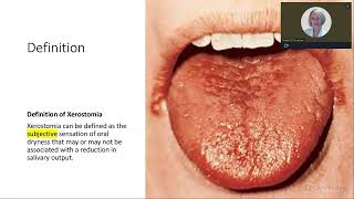 XEROSTOMIA TREATING DRY MOUTH TO IMPROVE PATIENT OUTCOMES [upl. by Chadabe353]