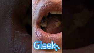 Gleek mouthsounds gleek [upl. by Germano]