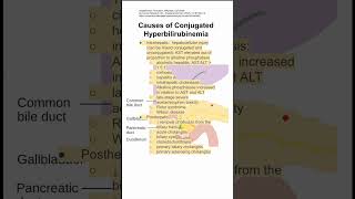 Causes of Conjugated Hyperbilirubinemia [upl. by Gustafsson]