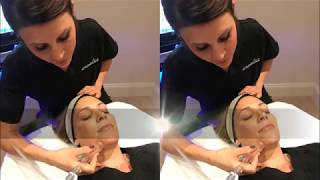 Lymphatic Drainage  HydraFacial MD  Artemedica Santa Rosa [upl. by Latif]