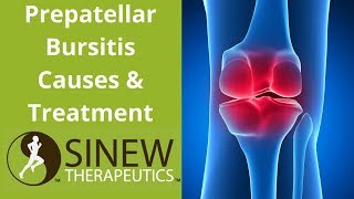 Prepatellar Bursitis Causes and Treatment [upl. by Haletta616]