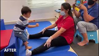 Physical Therapy for Children  Conditions amp Improvements Before amp After Therapy [upl. by Calhoun]