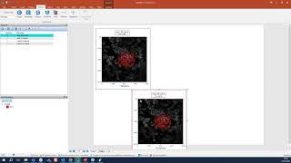 Getting Started with FCS Express 7 Image Cytometry [upl. by Aytak651]