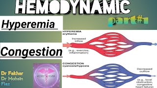 Hemodynamic disorder part  1 Hyperemia and congestion [upl. by Suiravat388]