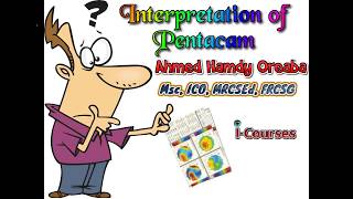 Pentacam Interpretation English [upl. by Naira]