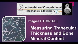 ImageJ Tutorial  Measurements of trabecular thickness bone fraction area using threshold colors [upl. by Aidam918]