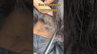 How to remove nits and lice treatment nits hair headlice haircare nitsremoval headliceremoval [upl. by Satsoc]