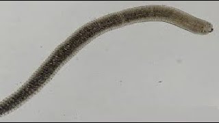 Para GIT  Hymenolepis Nana  Dwarf tape worm   الدودة القزمة [upl. by Garvy]