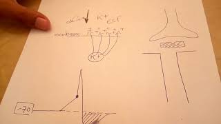 Case Familial Periodic Hypokalemic Paralysis [upl. by Yecad]