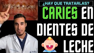 Las CARIES en niños con DIENTES DE LECHE no hace falta tratarlas 🤥¡MENTIRA [upl. by Vivl]